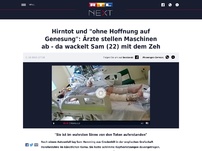 Bild zum Artikel: Hirntot und 'ohne Hoffnung auf Genesung': Ärzte stellen Maschinen ab - da wackelt Sam (22) mit dem Zeh