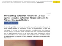 Bild zum Artikel: Etwas schlug auf seinen Hinterkopf. 10 Tage später schaut er auf seinen Körper und kann die Tränen nicht zurückhalten.