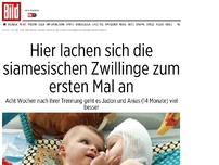 Bild zum Artikel: Siamesische Zwillinge - Hier lachen sie sich zum ersten Mal an