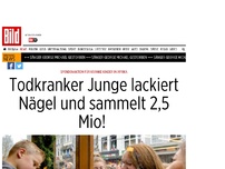 Bild zum Artikel: Für kranke Kinder in Afrika - Todkranker Junge lackiert Nägel und sammelt 2,5 Mio! 