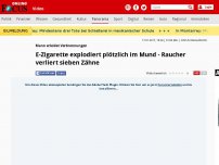 Bild zum Artikel: Mann erleidet Verbrennungen - E-Zigarette explodiert plötzlich im Mund - Raucher verliert sieben Zähne