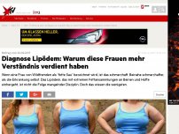 Bild zum Artikel: Beitrag vom 22.02.2017: Diagnose Lipödem: Warum diese Frauen mehr Verständnis verdient haben