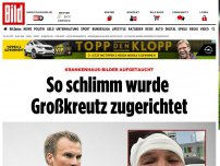 Bild zum Artikel: Bilder aufgetaucht - So schlimm wurde Großkreutz zugerichtet