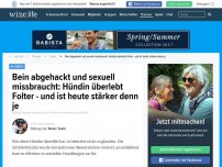 Bild zum Artikel: Bein abgehackt und sexuell missbraucht: Hündin überlebt Folter - und ist heute stärker denn je