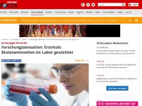 Bild zum Artikel: Forschungssensation - Durchbruch für Blutkrebs-Therapie: Erstmals Blutstammzellen im Labor gezüchtet