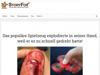 Bild zum Artikel: Das populäre Spielzeug explodierte in seiner Hand, weil er es zu schnell gedreht hatte!