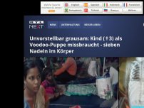 Bild zum Artikel: Unvorstellbar grausam: Kind (✝3) als Voodoo-Puppe missbraucht - sieben Nadeln im Körper