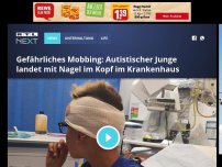 Bild zum Artikel: Gefährliches Mobbing: Autistischer Junge landet mit Nagel im Kopf im Krankenhaus