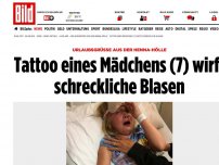 Bild zum Artikel: Henna-Hölle - Tattoo eines Mädchens (7) wirft schreckliche Blasen