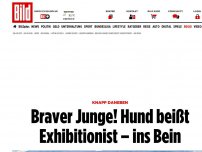 Bild zum Artikel: Knapp daneben - Braver Junge! Hund beißt Exhibitionist – ins Bein