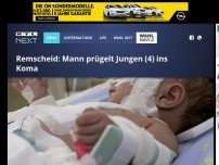 Bild zum Artikel: Remscheid: Mann prügelt Jungen (4) ins Koma