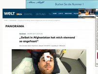 Bild zum Artikel: Angriff auf Flüchtling: 'Selbst in Afghanistan hat mich niemand so angefasst'