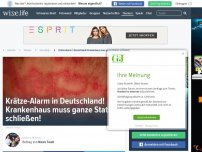 Bild zum Artikel: Krätze-Alarm in Deutschland! Krankenhaus muss ganze Station schließen!