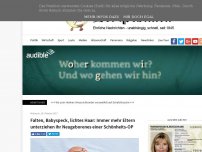 Bild zum Artikel: Falten, Babyspeck, lichtes Haar: Immer mehr Eltern unterziehen ihr Neugeborenes einer Schönheits-OP