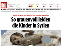 Bild zum Artikel: Assads Hunger-Blockaden - So grauenvoll leiden die Kinder in Syrien