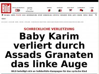 Bild zum Artikel: BILD solidarisiert sich - Baby Karim verliert durch Assads Granaten linkes Auge