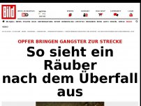 Bild zum Artikel: Opfer stellen Gangster - So sieht ein Räuber nach dem Überfall aus