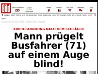 Bild zum Artikel: Fahndung im Taunus - Busfahrer (71) nach Prügelattacke erblindet