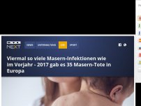 Bild zum Artikel: Wegen sinkender Impfquote: 2017 haben sich die Masern-Infektionen vervierfacht