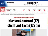 Bild zum Artikel: Messer-Attacke - Klassenkamerad (12) sticht auf Luca (12) ein