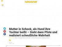 Bild zum Artikel: Mutter in Schock, als Hund ihre Tochter beißt – Sieht dann Pfote und realisiert scheußliche Wahrheit