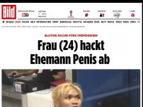 Bild zum Artikel: Rache fürs Fremdgehen - Frau (24) hackt Ehemann Penis ab