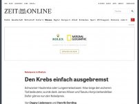 Bild zum Artikel: Nobelpreis in Medizin: Den Krebs einfach ausgebremst