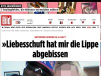 Bild zum Artikel: Betrüger wieder in U-Haft - »Liebesschuft hat mir die Lippe abgebissen