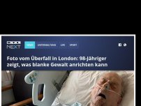 Bild zum Artikel: Foto geht viral: 98-Jähriger zeigt, was blanke Gewalt anrichten kann