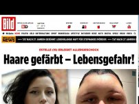 Bild zum Artikel: Allergie! Lebensgefahr! - Haare gefärbt – Kopf fast geplatzt