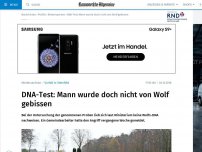 Bild zum Artikel: Ministerium: Mann wurde nicht von Wolf gebissen