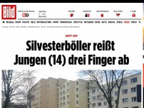 Bild zum Artikel: Explosion in der Hand - Silvesterböller reißt Jungen (14) drei Finger ab
