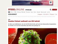 Bild zum Artikel: Aids: Zweiter Patient weltweit von HIV befreit