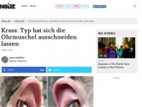 Bild zum Artikel: Krass: Typ hat sich die Ohrmuschel ausschneiden lassen