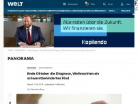 Bild zum Artikel: Ende Oktober die Diagnose, Weihnachten ein schwerstbehindertes Kind