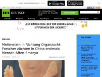 Bild zum Artikel: Meilenstein in Richtung Organzucht: Forscher züchten in China erstmals Mensch-Affen-Embryo