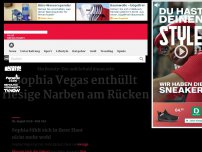 Bild zum Artikel: Sophia Vegas enthüllt riesige Narben am Rücken
