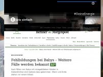 Bild zum Artikel: Neugeborene: Fehlbildungen bei Babys – Weitere Fälle werden bekannt