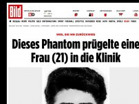 Bild zum Artikel: Weil sie ihn zurückwies - Dieses Phantom prügelte Frau (21) in die Klinik