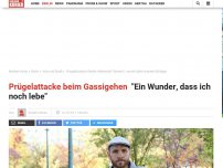 Bild zum Artikel: Prügelattacke beim Gassigehen: 'Ein Wunder, dass ich noch lebe'