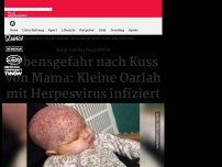Bild zum Artikel: Kleine Oarlah mit Herpes infiziert