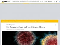 Bild zum Artikel: Neue Symptome: Das Coronavirus kann auch ins Gehirn vordringen