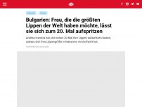 Bild zum Artikel: Bulgarien: Frau, die die größten Lippen der Welt haben möchte, lässt sie sich zum 20. Mal aufspritzen