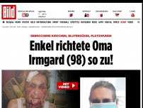 Bild zum Artikel: Gebrochene Knochen, Blutergüsse, Platzwunde - Enkel richtete Oma Irmgard (98) so zu!