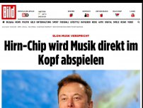 Bild zum Artikel: Elon Musk verspricht - Hirn-Chip wird Musik direkt im Kopf abspielen