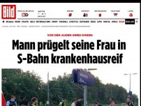 Bild zum Artikel: Vor den Augen ihres Kindes - Mann prügelt seine Frau in S-Bahn krankenhausreif