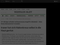 Bild zum Artikel: Bielefeld: Iraner hat sich selbst Hakenkreuz in die Haut geritzt