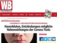 Bild zum Artikel: Nasenbluten, Entzündungen: mögliche Nebenwirkungen der Corona-Tests