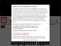 Bild zum Artikel: Ronja (24) wollte putzen gehen - Job-Absage wegen aufgespritzer Lippen