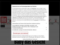 Bild zum Artikel: Während Not-Kaiserschnitt - Ärzte zerschneiden Baby das Gesicht